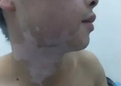 phpvcVgG7