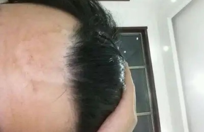 phpRCUYWX