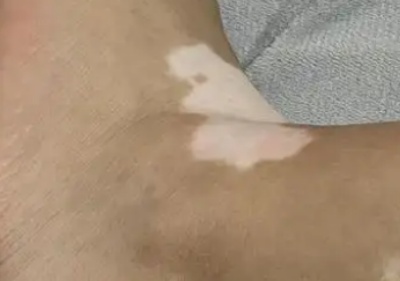 phpGGxzyW